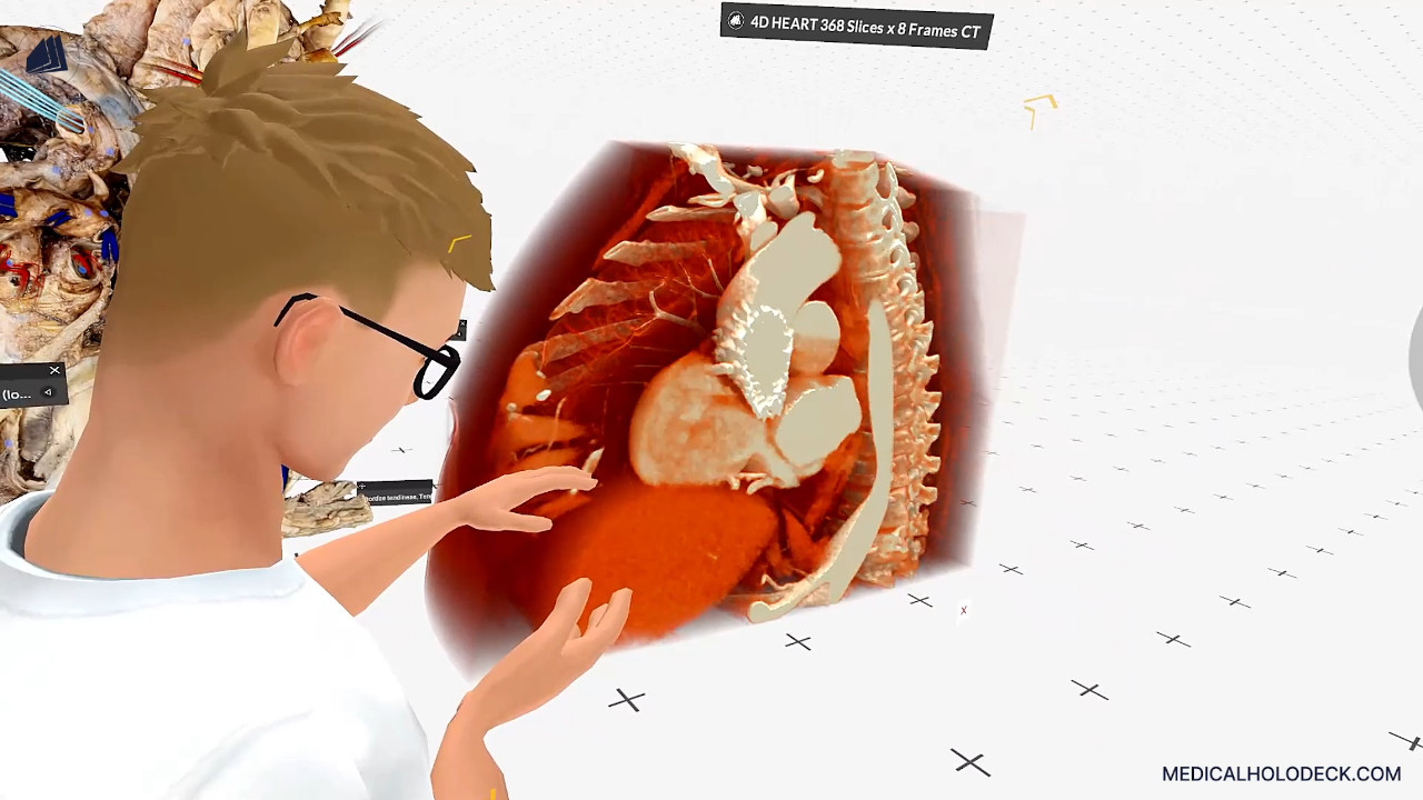 The heart valves thumbnail 2